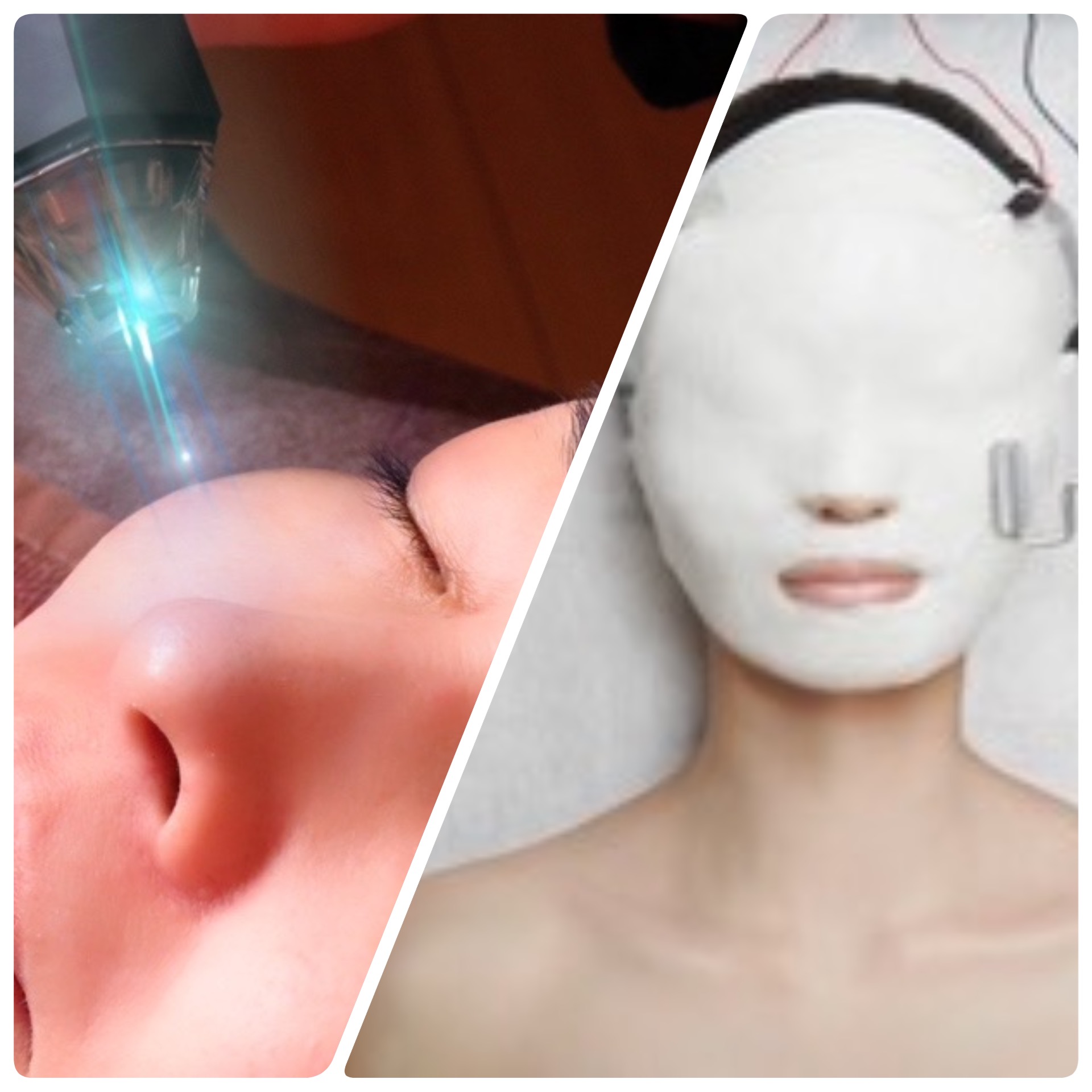 フェイシャル[新規]